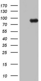 ECE-1 Antibody - HEK293T cells were transfected with the pCMV6-ENTRY control (Left lane) or pCMV6-ENTRY ECE1 (Right lane) cDNA for 48 hrs and lysed. Equivalent amounts of cell lysates (5 ug per lane) were separated by SDS-PAGE and immunoblotted with anti-ECE1.