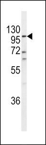 ECE-1 Antibody - Western blot of ECE-1 Antibody in A2058 cell line lysates (35 ug/lane). ECE-1 (arrow) was detected using the purified antibody.