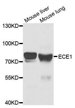 ECE-1 Antibody - Western blot analysis of extracts of various cell lines.