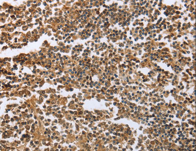 ECE-1 Antibody - Immunohistochemistry of paraffin-embedded Human tonsil using ECE1 Polyclonal Antibody at dilution of 1:60.