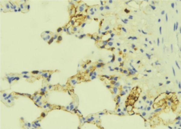 ECE-1 Antibody - 1:100 staining mouse lung tissue by IHC-P. The sample was formaldehyde fixed and a heat mediated antigen retrieval step in citrate buffer was performed. The sample was then blocked and incubated with the antibody for 1.5 hours at 22°C. An HRP conjugated goat anti-rabbit antibody was used as the secondary.