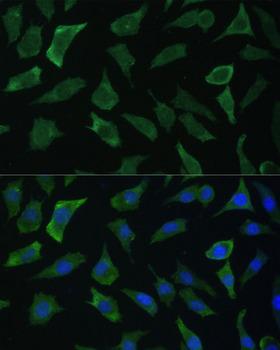 ECE-1 Antibody - Immunofluorescence analysis of L929 cells using ECE1 Polyclonal Antibody at dilution of 1:100 (40x lens).Blue: DAPI for nuclear staining.