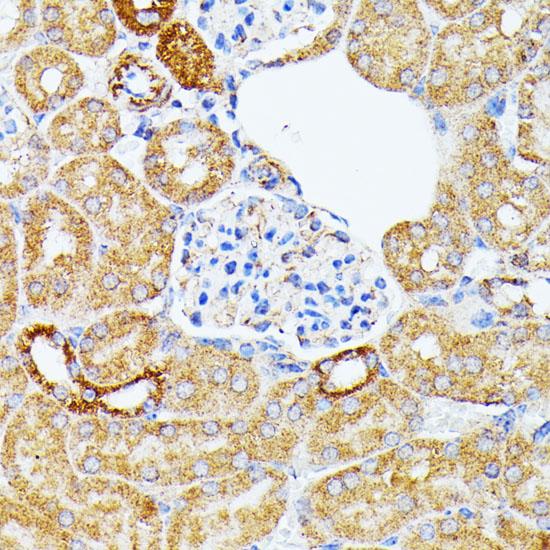 ECE-1 Antibody - Immunohistochemistry of paraffin-embedded Mouse kidney using ECE1 Polyclonal Antibody at dilution of 1:100 (40x lens).