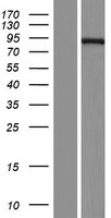 ECE-1 Protein - Western validation with an anti-DDK antibody * L: Control HEK293 lysate R: Over-expression lysate