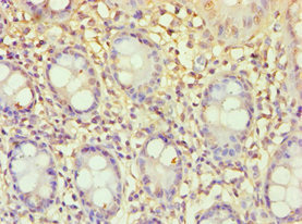ECE2 Antibody - Immunohistochemistry of paraffin-embedded human colon tissue using ECE2 Antibody at dilution of 1:100