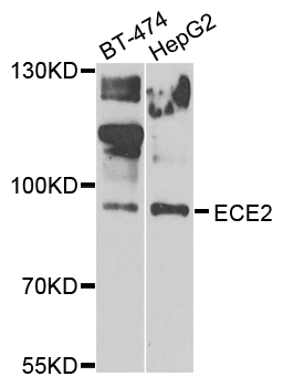 ECE2 Antibody - Western blot analysis of extracts of various cells.