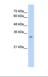 ECH1 Antibody - HepG2 cell lysate. Antibody concentration: 2.5 ug/ml. Gel concentration: 12%.  This image was taken for the unconjugated form of this product. Other forms have not been tested.
