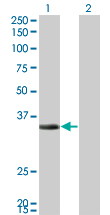 ECH1 Antibody - Western Blot analysis of ECH1 expression in transfected 293T cell line by ECH1 monoclonal antibody (M01), clone 5G8.Lane 1: ECH1 transfected lysate(35.8 KDa).Lane 2: Non-transfected lysate.