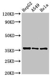 ECH1 Antibody - Positive Western Blot detected in HepG2 whole cell lysate, A549 whole cell lysate, Hela whole cell lysate. All lanes: ECH1 antibody at 2.5 µg/ml Secondary Goat polyclonal to rabbit IgG at 1/50000 dilution. Predicted band size: 36 KDa. Observed band size: 36 KDa