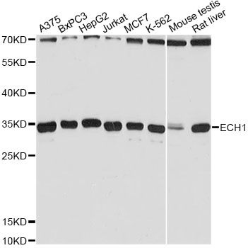 ECH1 Antibody - Western blot analysis of extracts of various cell lines, using ECH1 Antibody at 1:3000 dilution. The secondary antibody used was an HRP Goat Anti-Rabbit IgG (H+L) at 1:10000 dilution. Lysates were loaded 25ug per lane and 3% nonfat dry milk in TBST was used for blocking. An ECL Kit was used for detection and the exposure time was 10s.