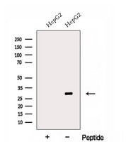 ECH1 Antibody - Western blot analysis of extracts of HepG2 cells using ECH1 antibody. The lane on the left was treated with blocking peptide.