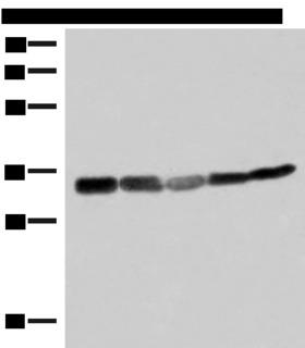 ECH1 Antibody - Western blot analysis of 293T HepG2 and A549 cell lysates  using ECH1 Polyclonal Antibody at dilution of 1:200
