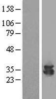 ECH1 Protein - Western validation with an anti-DDK antibody * L: Control HEK293 lysate R: Over-expression lysate