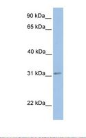 ECHDC2 Antibody - 721_B cell lysate. Antibody concentration: 1.0 ug/ml. Gel concentration: 12%.  This image was taken for the unconjugated form of this product. Other forms have not been tested.