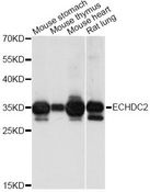 ECHDC2 Antibody - Western blot analysis of extracts of various cell lines, using ECHDC2 antibody at 1:1000 dilution. The secondary antibody used was an HRP Goat Anti-Rabbit IgG (H+L) at 1:10000 dilution. Lysates were loaded 25ug per lane and 3% nonfat dry milk in TBST was used for blocking. An ECL Kit was used for detection and the exposure time was 32s.