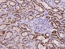 ECHDC2 Antibody - Immunochemical staining of human ECHDC2 in human kidney with rabbit polyclonal antibody at 1:100 dilution, formalin-fixed paraffin embedded sections.