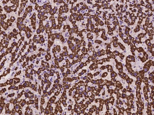 ECHDC2 Antibody - Immunochemical staining of human ECHDC2 in human liver with rabbit polyclonal antibody at 1:100 dilution, formalin-fixed paraffin embedded sections.
