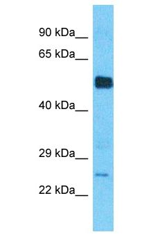 ECI1 / DCI Antibody - DCI / ECI1 antibody Western Blot of Thymus Tumor. Antibody dilution: 1 ug/ml.  This image was taken for the unconjugated form of this product. Other forms have not been tested.