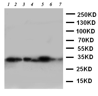 ECI1 / DCI Antibody - WB of DCI / ECI1 antibody. Lane 1: Rat Liver Tissue Lysate. Lane 2: Human Placenta Tissue Lysate. Lane 3: A549 Cell Lysate. Lane 4: SMMC Cell Lysate . Lane 5: COLO320 Cell Lysate . Lane 6: HELA Cell Lysate . Lane 7: HT1080 Cell Lysate.