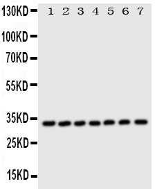 ECI1 / DCI Antibody - Western blot analysis of DCI using anti-DCI antibody. Electrophoresis was performed on a 5-20% SDS-PAGE gel at 70V (Stacking gel) / 90V (Resolving gel) for 2-3 hours. The sample well of each lane was loaded with 50ug of sample under reducing conditions. Lane 1: Rat Liver Tissue Lysate, Lane 2: Human Placenta Tissue Lysate, Lane 3: A549 Whole Cell Lysate, Lane 4: SMMC Whole Cell Lysate, Lane 5: COLO320 Whole Cell Lysate, Lane 6: HELA Whole Cell Lysate, Lane 7: HT1080 Whole Cell Lysate, After Electrophoresis, proteins were transferred to a Nitrocellulose membrane at 150mA for 50-90 minutes. Blocked the membrane with 5% Non-fat Milk/ TBS for 1.5 hour at RT. The membrane was incubated with rabbit anti-DCI antigen affinity purified polyclonal antibody at 0.5 µg/mL overnight at 4°C, then washed with TBS-0.1% Tween 3 times with 5 minutes each and probed with a goat anti-rabbit IgG-HRP secondary antibody at a dilution of 1:10000 for 1.5 hour at RT. The signal is developed using an Enhanced Chemiluminescent detection (ECL) kit with Tanon 5200 system. A specific band was detected for DCI at approximately 33KD. The expected band size for DCI is at 33KD.