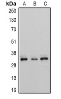 ECI1 / DCI Antibody - Western blot analysis of ECI1 expression in A549 (A); HeLa (B); MCF7 (C) whole cell lysates.
