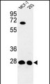 ECI1 / DCI Antibody - Western blot analysis of DCI Antibody (C-term) in MCF-7, 293 cell line lysates (35ug/lane). DCI (arrow) was detected using the purified Pab.