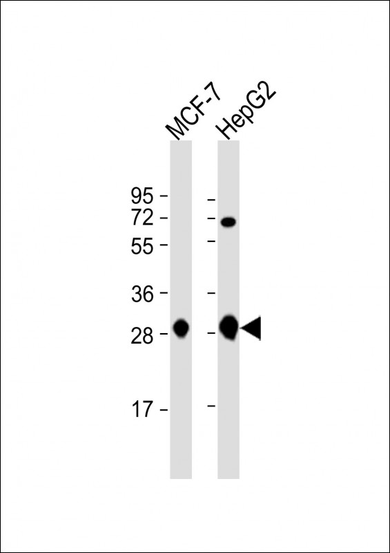 ECI1 / DCI Antibody - All lanes: Anti-DCI Antibody (C-term) at 1:1000 dilution Lane 1: MCF-7 whole cell lysate Lane 2: HepG2 whole cell lysate Lysates/proteins at 20 µg per lane. Secondary Goat Anti-Rabbit IgG, (H+L), Peroxidase conjugated at 1/10000 dilution. Predicted band size: 33 kDa Blocking/Dilution buffer: 5% NFDM/TBST.