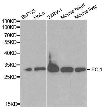 ECI1 / DCI Antibody - Western blot analysis of extracts of various cell lines.