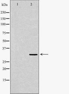 ECI1 / DCI Antibody - Western blot analysis of 293T whole cells lysates using ECI1 antibody. The lane on the left is treated with the antigen-specific peptide.