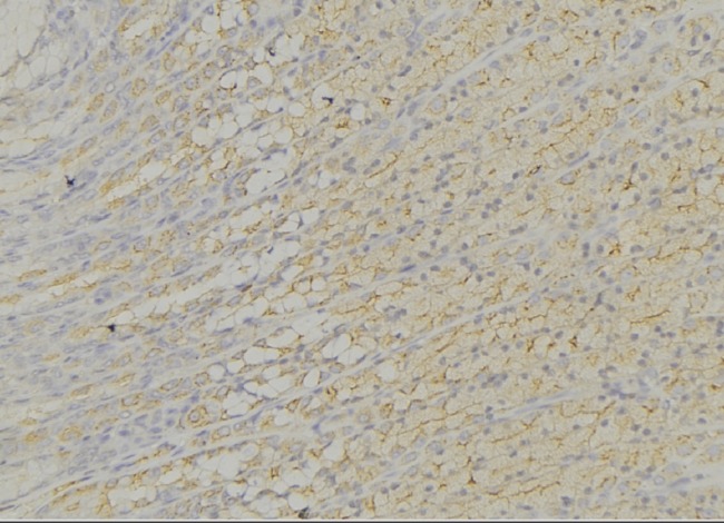 ECI1 / DCI Antibody - 1:100 staining human gastric tissue by IHC-P. The sample was formaldehyde fixed and a heat mediated antigen retrieval step in citrate buffer was performed. The sample was then blocked and incubated with the antibody for 1.5 hours at 22°C. An HRP conjugated goat anti-rabbit antibody was used as the secondary.