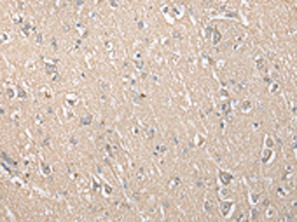 ECI1 / DCI Antibody - Immunohistochemistry of paraffin-embedded Human brain tissue  using ECI1 Polyclonal Antibody at dilution of 1:30(×200)