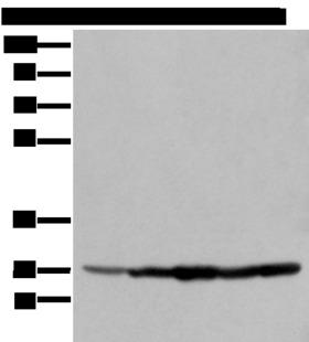 ECI1 / DCI Antibody - Western blot analysis of 293T cell Hela cell A549 cell  using ECI1 Polyclonal Antibody at dilution of 1:350