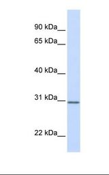 ECI1 / DCI Antibody - Fetal brain lysate. Antibody concentration: 1.0 ug/ml. Gel concentration: 12%.  This image was taken for the unconjugated form of this product. Other forms have not been tested.