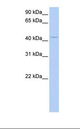 ECI2 / PECI Antibody - HepG2 cell lysate. Antibody concentration: 1.0 ug/ml. Gel concentration: 12%.  This image was taken for the unconjugated form of this product. Other forms have not been tested.