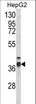 ECI2 / PECI Antibody - Western blot of PECI Antibody in HepG2 cell line lysates (35 ug/lane). PECI (arrow) was detected using the purified antibody.