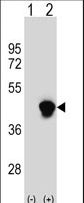 ECI2 / PECI Antibody - Western blot of PECI (arrow) using rabbit polyclonal PECI Antibody. 293 cell lysates (2 ug/lane) either nontransfected (Lane 1) or transiently transfected (Lane 2) with the PECI gene.