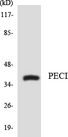 ECI2 / PECI Antibody - Western blot analysis of the lysates from COLO205 cells using PECI antibody.