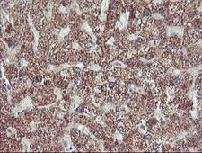 ECI2 / PECI Antibody - IHC of paraffin-embedded Human liver tissue using anti-PECI mouse monoclonal antibody. (Heat-induced epitope retrieval by 10mM citric buffer, pH6.0, 100C for 10min).