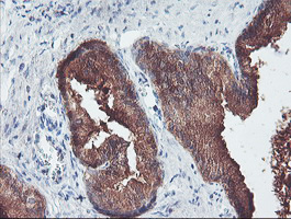 ECI2 / PECI Antibody - IHC of paraffin-embedded Human prostate tissue using anti-PECI mouse monoclonal antibody. (Heat-induced epitope retrieval by 10mM citric buffer, pH6.0, 100C for 10min).
