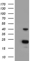 ECI2 / PECI Antibody - HEK293T cells were transfected with the pCMV6-ENTRY control (Left lane) or pCMV6-ENTRY PECI (Right lane) cDNA for 48 hrs and lysed. Equivalent amounts of cell lysates (5 ug per lane) were separated by SDS-PAGE and immunoblotted with anti-PECI.