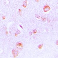 ECI2 / PECI Antibody - Immunohistochemical analysis of PECI staining in human brain formalin fixed paraffin embedded tissue section. The section was pre-treated using heat mediated antigen retrieval with sodium citrate buffer (pH 6.0). The section was then incubated with the antibody at room temperature and detected using an HRP conjugated compact polymer system. DAB was used as the chromogen. The section was then counterstained with hematoxylin and mounted with DPX.