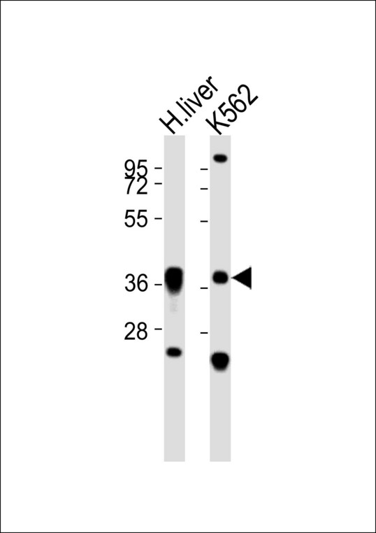 ECI2 / PECI Antibody - All lanes : Anti-PECI Antibody at 1:1000 dilution Lane 1: H.liver tissue lysates Lane 2: K562 whole cell lysates Lysates/proteins at 20 ug per lane. Secondary Goat Anti-Rabbit IgG, (H+L),Peroxidase conjugated at 1/10000 dilution Predicted band size : 44 kDa Blocking/Dilution buffer: 5% NFDM/TBST.