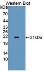 ECI2 / PECI Antibody - Western Blot; Sample: Recombinant protein.