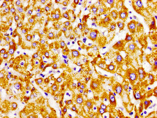 ECI2 / PECI Antibody - Immunohistochemistry image of paraffin-embedded human liver tissue at a dilution of 1:100
