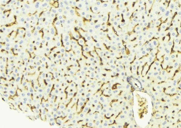 ECI2 / PECI Antibody - 1:100 staining mouse liver tissue by IHC-P. The sample was formaldehyde fixed and a heat mediated antigen retrieval step in citrate buffer was performed. The sample was then blocked and incubated with the antibody for 1.5 hours at 22°C. An HRP conjugated goat anti-rabbit antibody was used as the secondary.