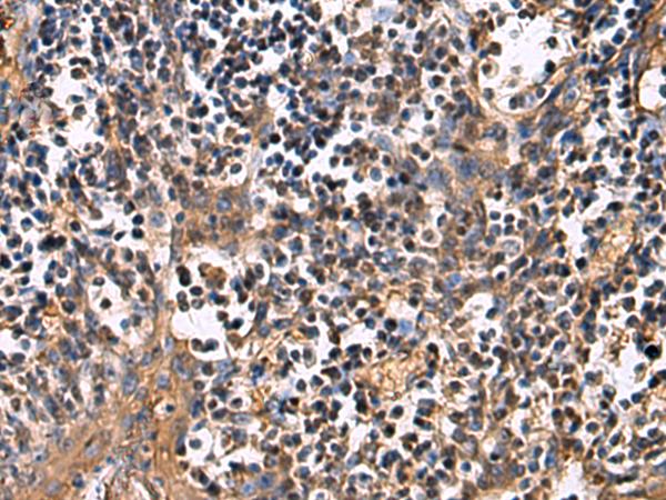 ECM1 Antibody - Immunohistochemistry of paraffin-embedded Human tonsil tissue  using ECM1 Polyclonal Antibody at dilution of 1:25(×200)
