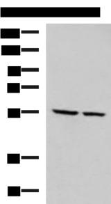 ECM1 Antibody - Western blot analysis of LOVO and LO2 cell lysates  using ECM1 Polyclonal Antibody at dilution of 1:650