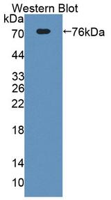 ECM1 Antibody - Western Blot; Sample: Recombinant protein.