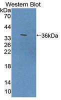 ECM1 Antibody - Western blot of ECM1 antibody.