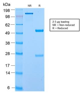 ECM1 Antibody - SDS-PAGE Analysis of Purified Secretory Component Rabbit Recombinant Monoclonal (ECM1/2889R). Confirmation of Purity and Integrity of Antibody.